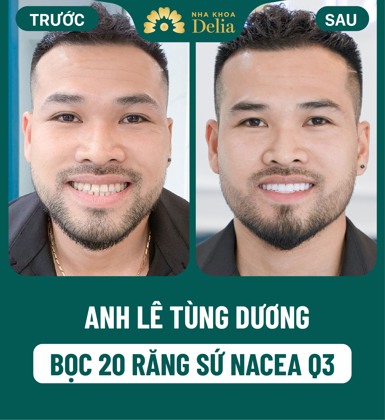 ảnh BA khách hàng