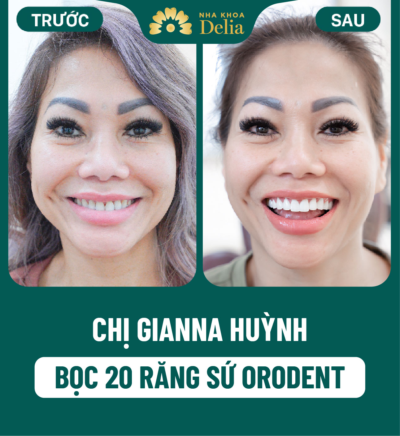 ảnh BA khách hàng