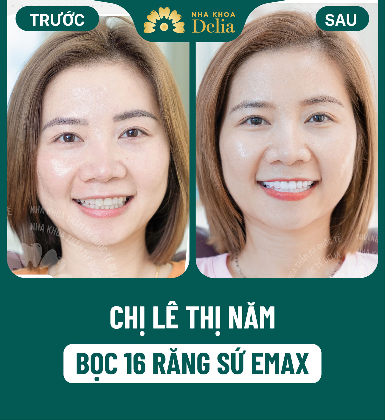 ảnh BA khách hàng