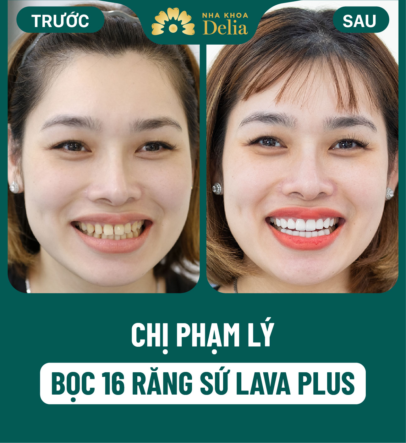 ảnh BA khách hàng