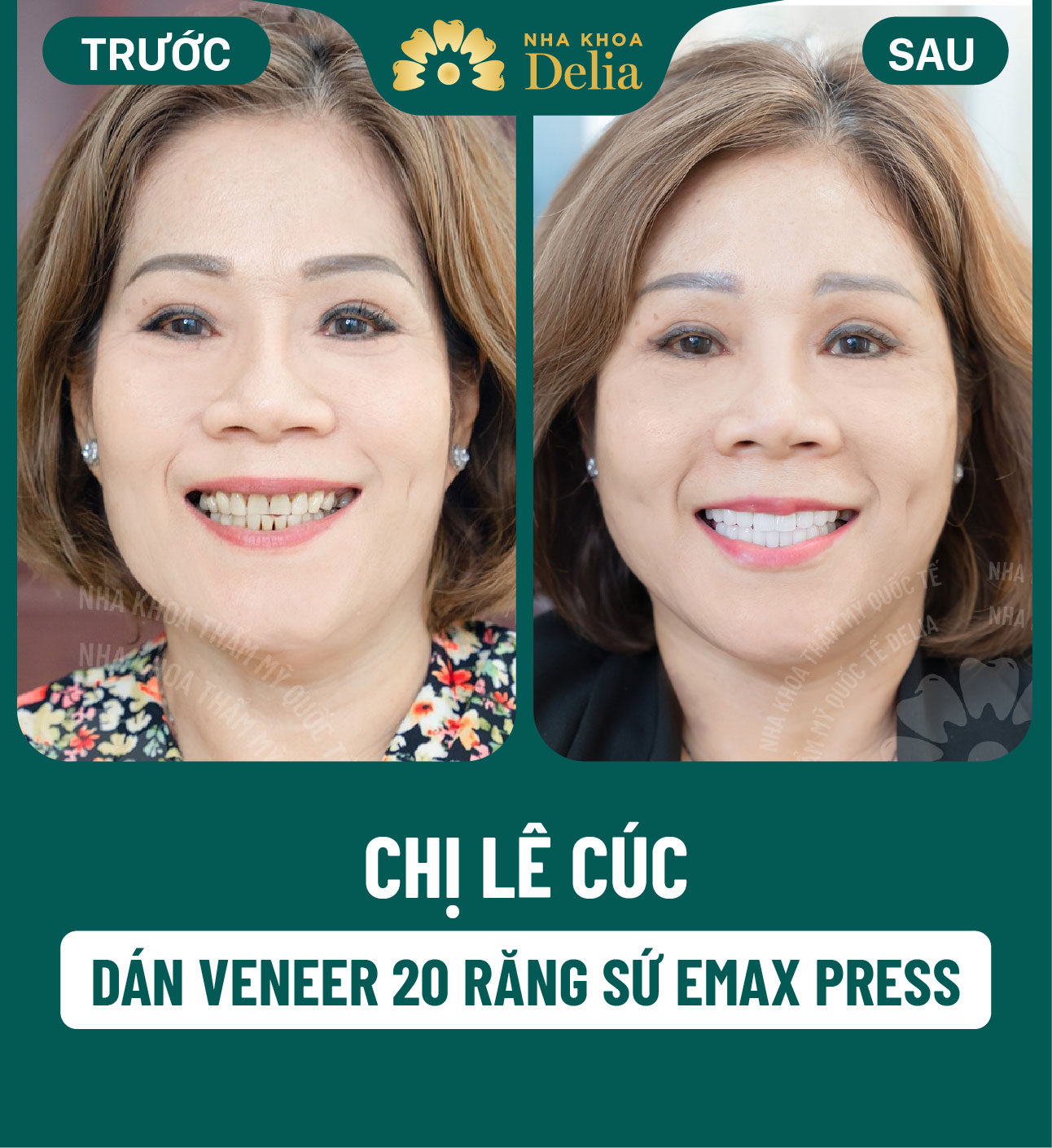 ảnh BA khách hàng