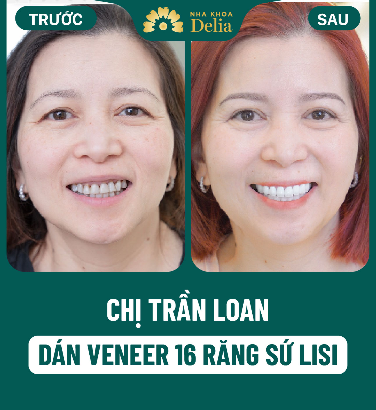 ảnh BA khách hàng