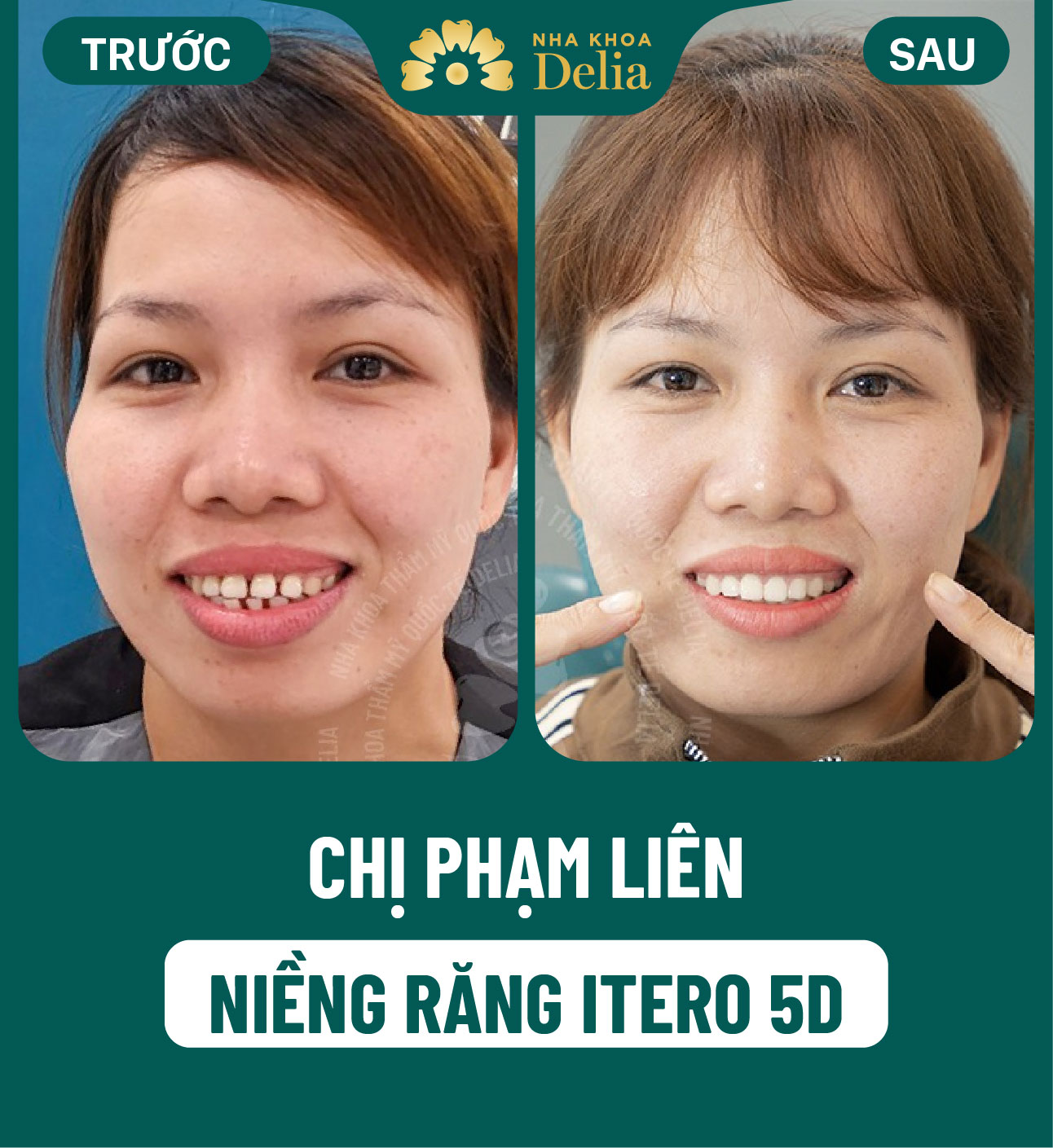 ảnh BA khách hàng
