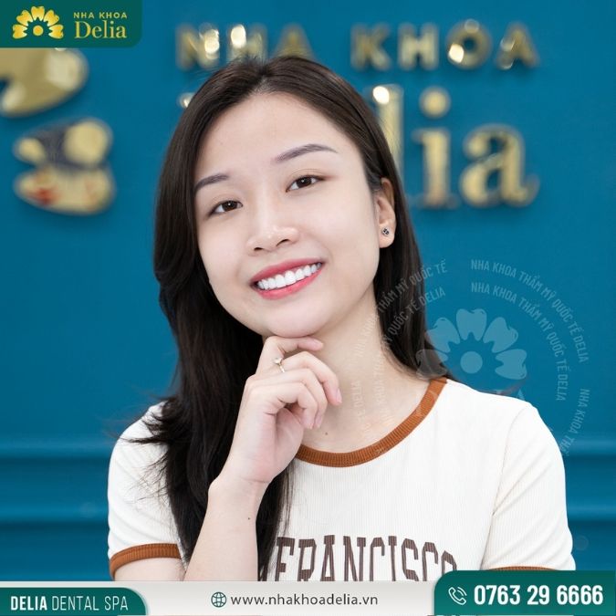 6 Kinh nghiệm “sương máu” để chọn được răng sứ phù hợp