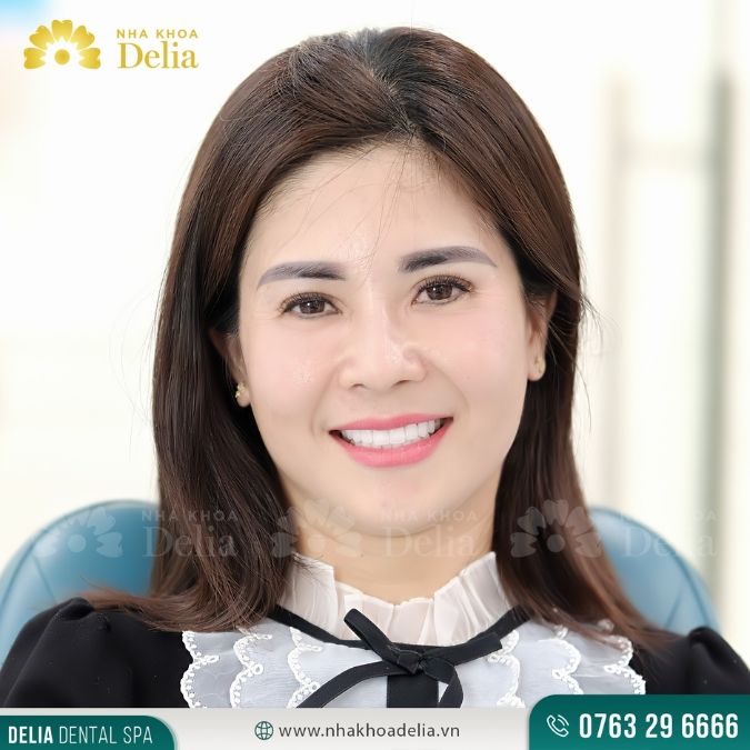 Giá bọc răng sứ dựa trên độ tinh khiết