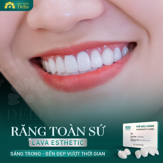 Giá bọc răng sứ dựa trên chất liệu 